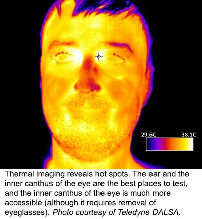 Thermal imaging reveals hot spots. The ear and the inner canthus of the eye are the best places to test, and the inner canthus of the eye is much more accessible (although it requires removal of eyeglasses). Photo courtesy of Teledyne DALSA. 